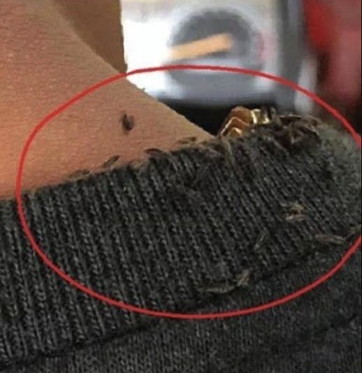 A Shocking Case That Crawled Across the Internet: The Viral Story of the Tricycle Driver With Severe Head Lice – theonlinestory.com